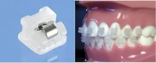 正畸透明氧化铝陶瓷托槽
